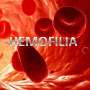 hemofilia (8)