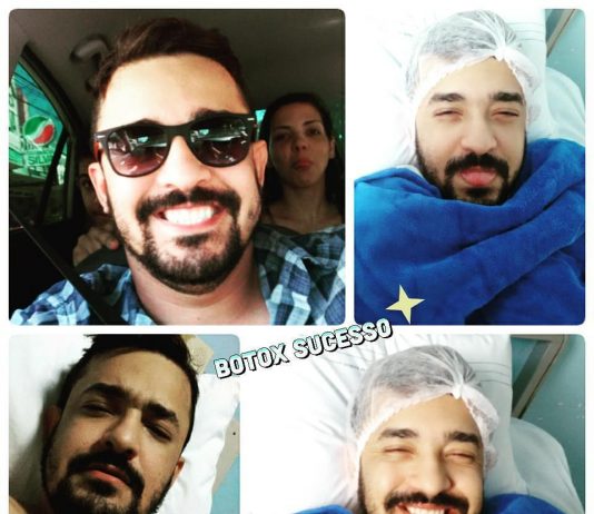 SOBRE MINHA 3ª APLICAÇÃO DE BOTOX NA BEXIGA