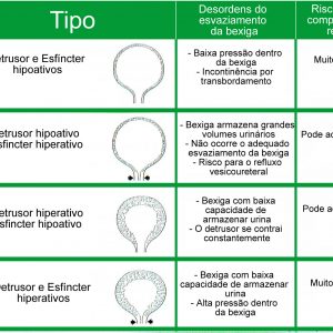 tipo-de-bexiga-hiperativa-neurogenica-tabeladesordembexiga