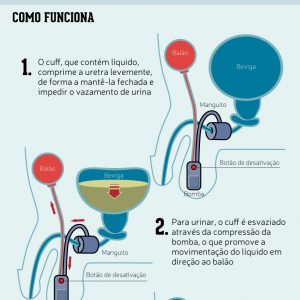 urinaria