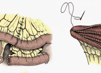 CONHEÇA O TRATAMENTO INDICADO PARA PESSOAS COM INCONTINÊNCIA URINÁRIA – AMPLIAÇÃO VESICAL