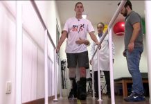 JAKSON FOLLMANN DÁ PRIMEIROS PASSOS COM NOVA PRÓTESE