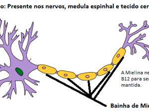 Esclerose-MC3BAltipla
