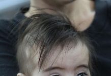 ANVISA LIBERA REMÉDIO INÉDITO NO BRASIL PARA ATROFIA MUSCULAR ESPINHAL