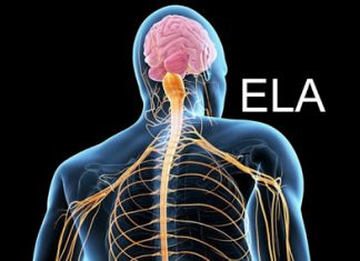 FALANDO SOBRE DOENÇA DO NEURÔNIO MOTOR (DNM): EMPRESA KADIMASTEM INICIARÁ ENSAIO CLÍNICO EM HUMANOS COM UMA TERAPIA PROMISSORA NA ELA