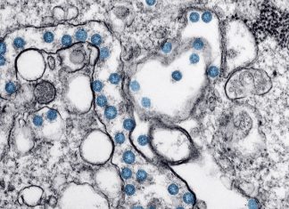 COVID-19: OMS DIVULGA GUIA COM CUIDADOS PARA SAÚDE MENTAL DURANTE PANDEMIA – VEJA O VÍDEO.